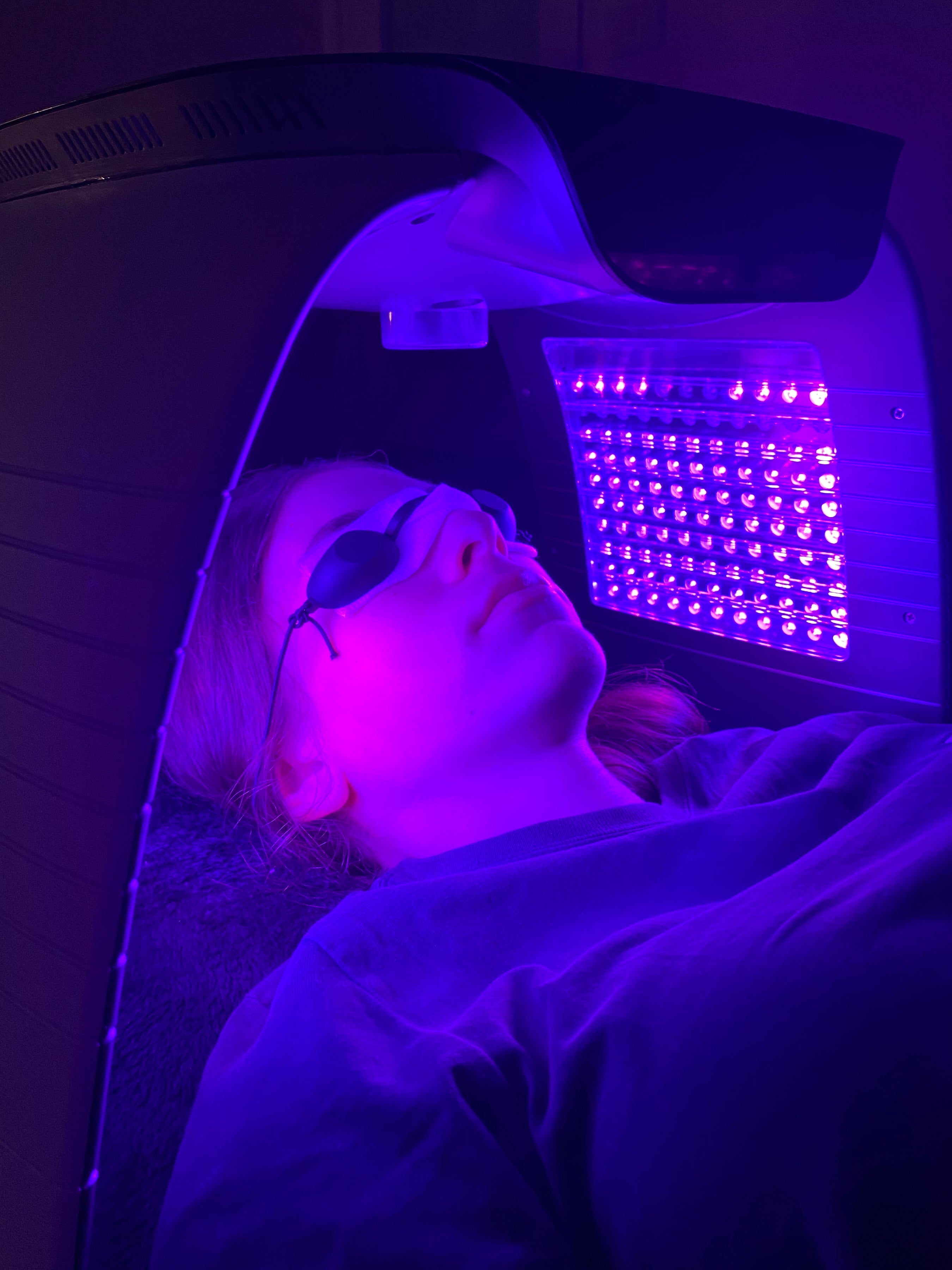 LED Light Therapy KMBEAUTY SYDNEY SKIN BEAUTY LOCATED IN